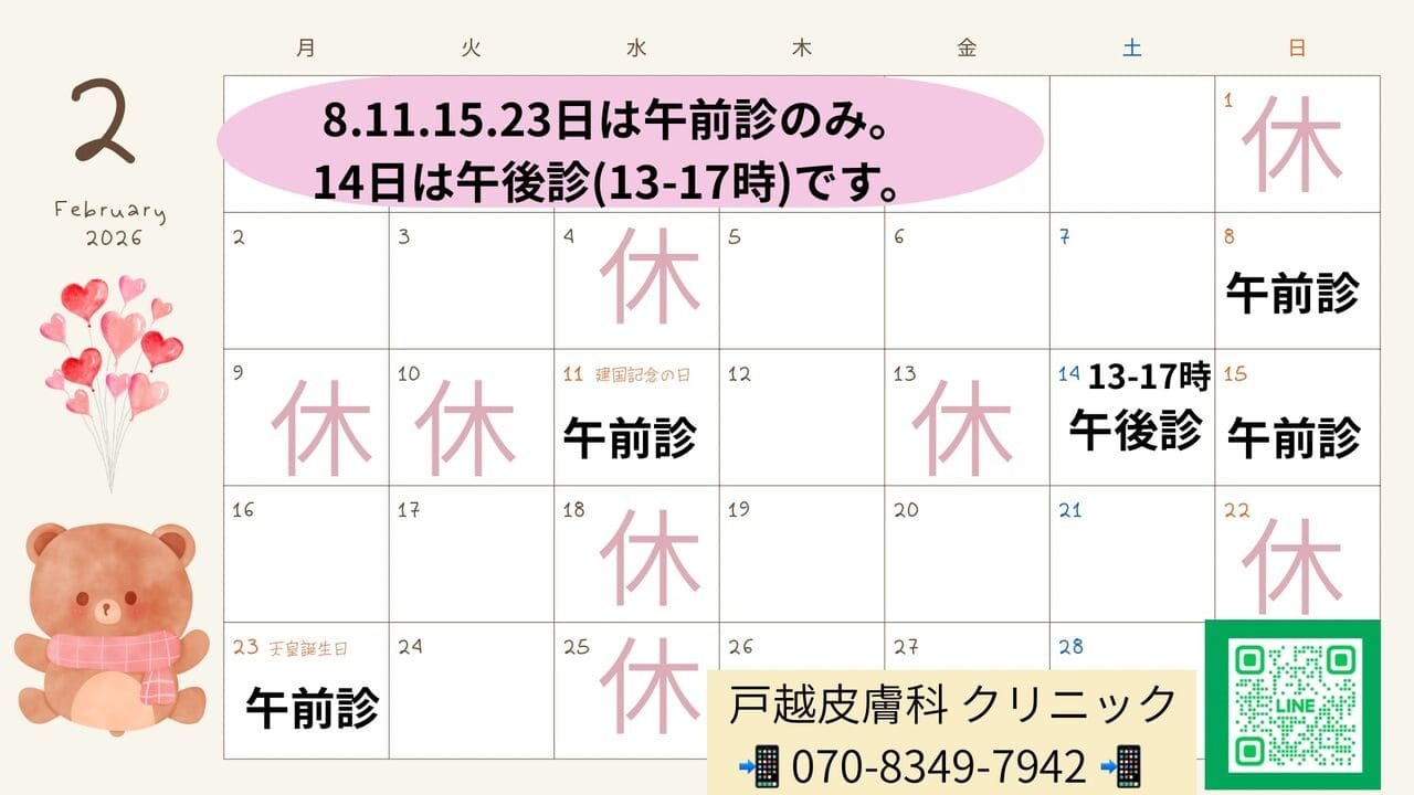 2月カレンダー